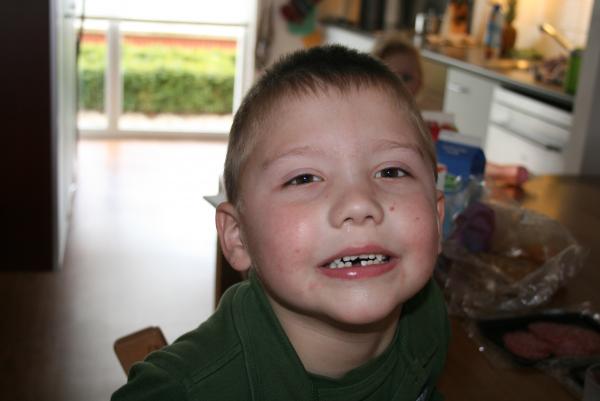 Merijn zijn tand is eruit!, geplaatst door mama Lizanne op 2009-03-16